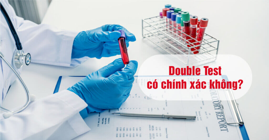 Ket-qua-xet-nghiem-sang-loc-truoc-sinh-Double-Test-co-chinh-xac-khong-thumbnail