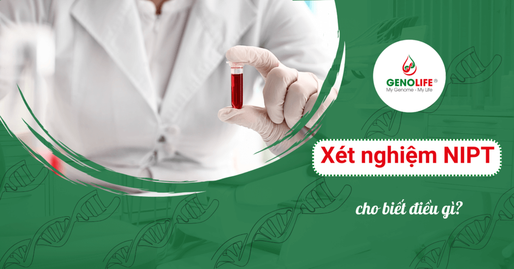 Xet-nghiem-nipt-tiet-lo-cho-me-dieu-gi-01