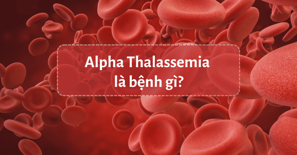 Alpha-Thalassemia-thumb