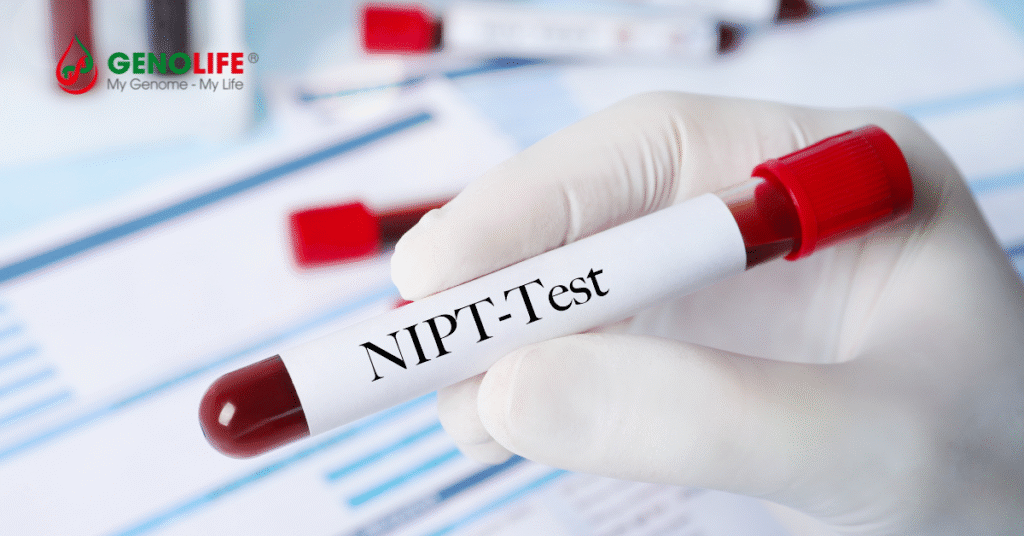 Xét nghiệm NIPT