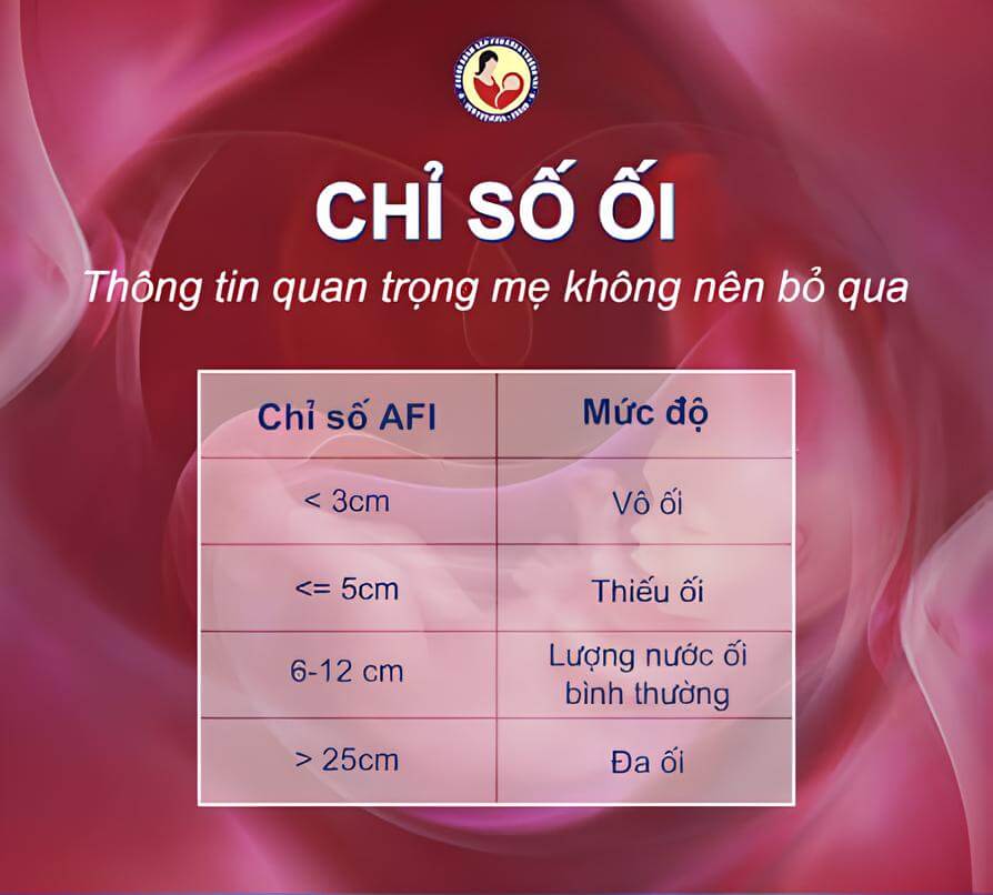 Chi so AFI