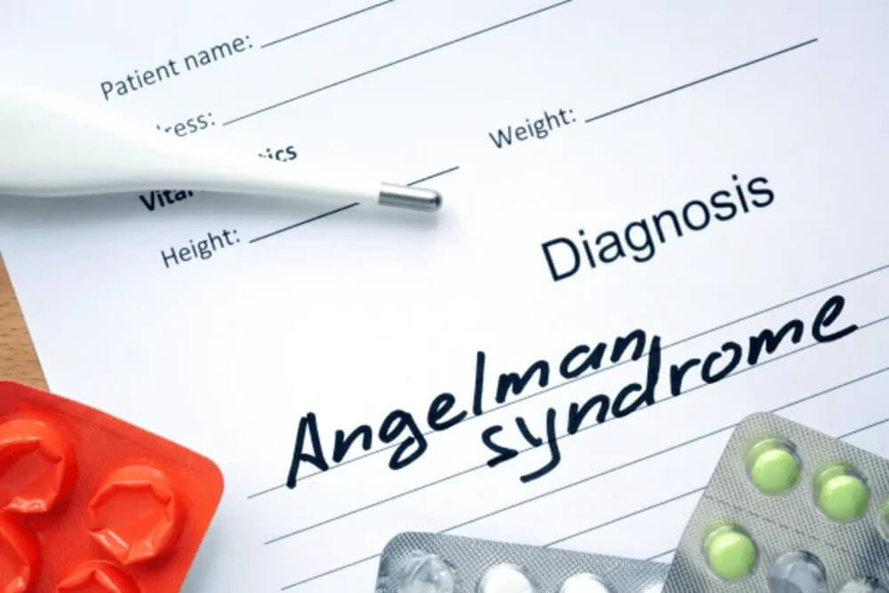 Phòng ngừa Angelman