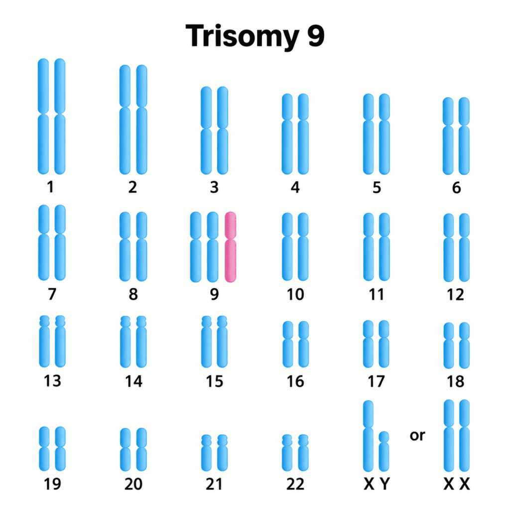 Trisomy 9