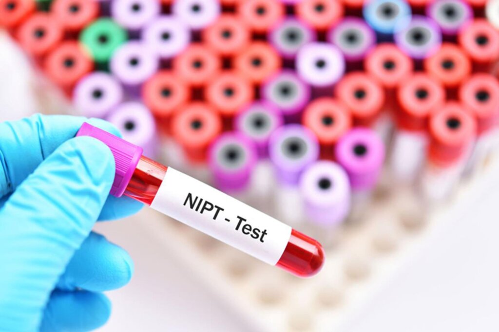 review xet nghiem NIPT